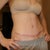 8 weeks post op
