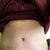 My Scar 4 weeks post op. I have some marks from my jeans and the compression garment, but my scar is healing nice.