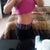 Side view (1 yr and 5 months post op)