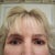 6 week post surgery with make-up