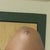 One month post op and there is still a lot of bruising from my arm lipo.