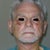 Fourth day after surgery. Note tighter jawline and neck, no jowls, lesser cheek hollows, less prominent lasonabial folds.