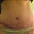 7WPO SWOLLEN
