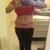 3 Months Post Op- Front View of Incision