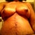 One week post-op