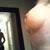 view of left breast from side