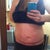 1 wk post, long view. Low belly button.