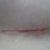 Left Incision 6 weeks