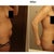May 2012 - 4 Months Post Op