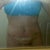 DAY 4 POST OP:Swollen tummy and vj but look at my definition!