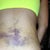 My dreaded back pain!
And it feels as painful as it looks !