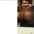 Big butt after :) 740cc's each 4 weeks post-op