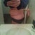 The other side view of when I bend over (before surgery)