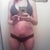 full body 25 days post op