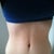 15 weeks post op