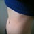 15 weeks post op