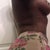 09/07/2012 4wks post