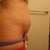 Side profile - the indent of my c-section is very unappealing and shows through a bathing suit.