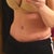 4 weeks post op