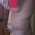 Now that's whath I'm talkin' 'bout!! bye-bye hematoma!