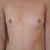 Before surgery