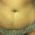 Before tummy tuck...extra skin and stretch marks