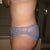 4 week post-op