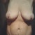 Front view no bra....eWWWWW