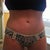 9 months post op and sooooo worth it!
