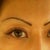 7 months post op, brows have been thinly tattooed in as well