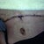 5 days post op laying down