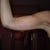 Arms 6 weeks post op