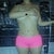 9 DAYS POST OP FRONT
