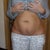 Front lower abdomen
