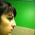 Before, poorly defined profile and small hump