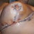 Post op day 3--righty