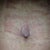 Belly Button at 4 weeks.  My PS has me packing my bb with gauze for 6 weeks.  This is to avoid it losing its round shape.
