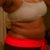 The morning of my surgery... my "before" pic