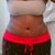 3wks 3 days postop