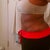 3wks 3 days postop