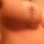 That's a looooong scar.  What evs!