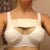 34 DD! Omg I hope the swelling goes down!post op day 1
