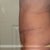 6 weeks after Full TT