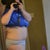 10 wks  po right side
