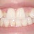 after 7 trays.