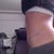 5 months post op-- still very swollen
