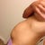 Pre-surgery side view