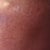 70 hour post-treatment (see the brown flakes?)