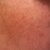 70 hour post-treatment (see the brown flakes?)