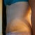 Left side 7 weeks. Swollen mainly around incision. also end of day picture swelling always worse later in day